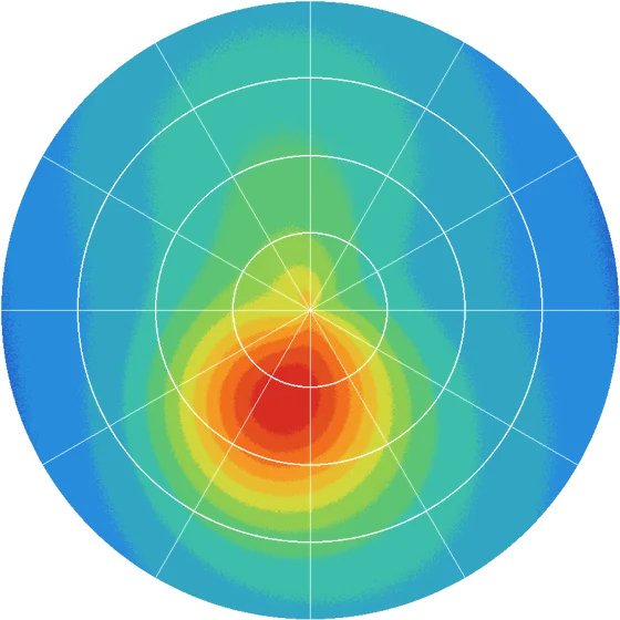 Axial curvature map of the same eye from an MS-39 a year later